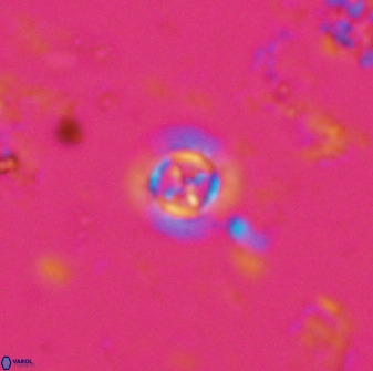 Prediscosphaera columnata 35631