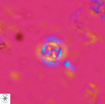 Prediscosphaera columnata 35631
