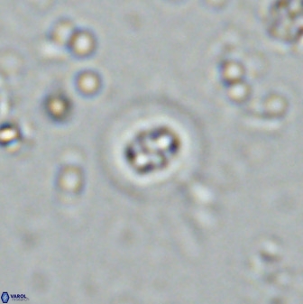 Prediscosphaera columnata 35632