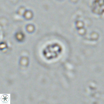 Prediscosphaera columnata 35632