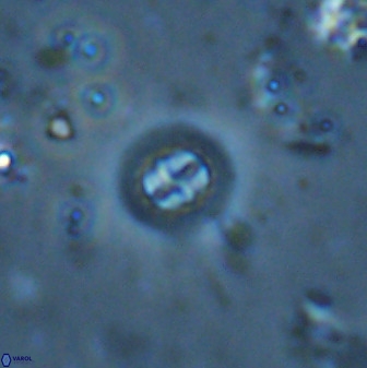 Prediscosphaera columnata 35633