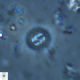 Prediscosphaera columnata 35633
