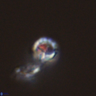 Prediscosphaera columnata 42026