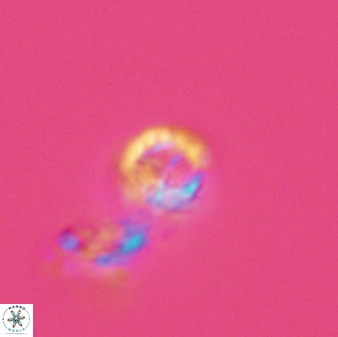 Prediscosphaera columnata 42027