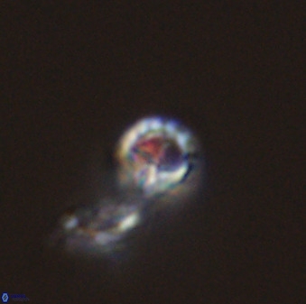 Prediscosphaera columnata 42028