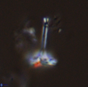 Prediscosphaera columnata 42036