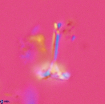 Prediscosphaera columnata 42037