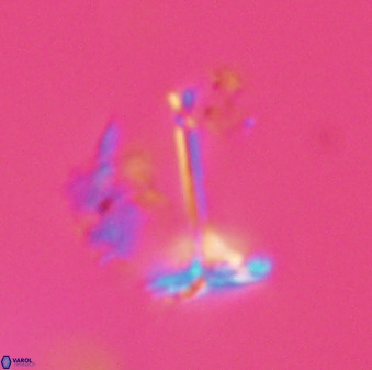 Prediscosphaera columnata 42031