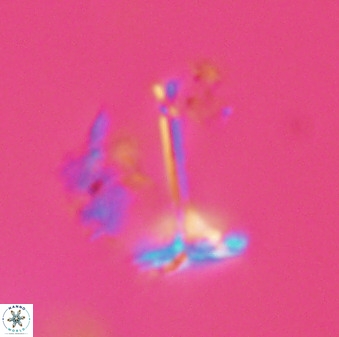 Prediscosphaera columnata 42031