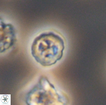 Prediscosphaera columnata 8078