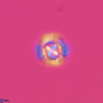 Prediscosphaera columnata 8354