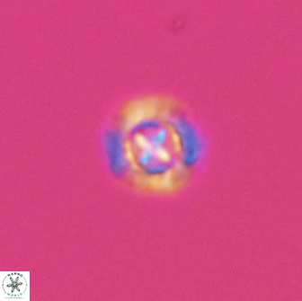 Prediscosphaera columnata 8354
