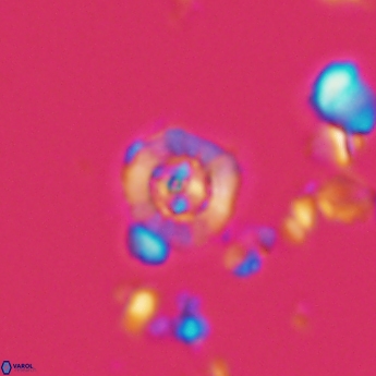 Prediscosphaera catinus 1237