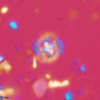Prediscosphaera catinus 17315