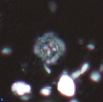 Prediscosphaera catinus 17316