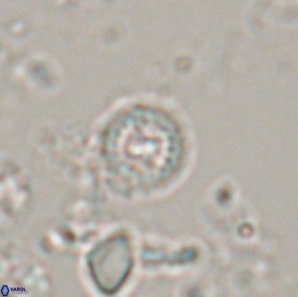 Prediscosphaera catinus 17318