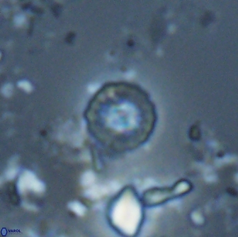 Prediscosphaera catinus 17319