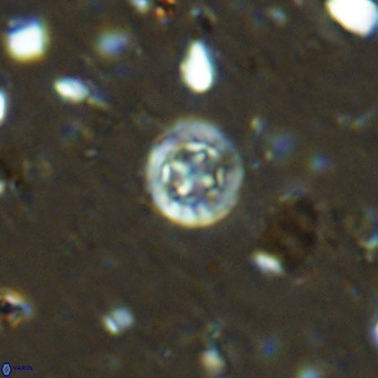 Prediscosphaera catinus VR 14685