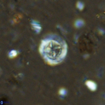 Prediscosphaera catinus VR 14688