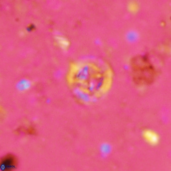 Prediscosphaera catinus VR 14689