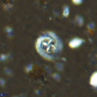 Prediscosphaera catinus VR 14695