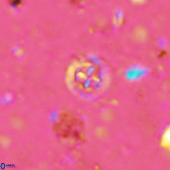 Prediscosphaera catinus VR 14696