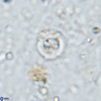 Prediscosphaera catinus VR 14699