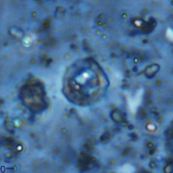 Prediscosphaera catinus VR 14709