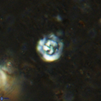 Prediscosphaera catinus VR 15763