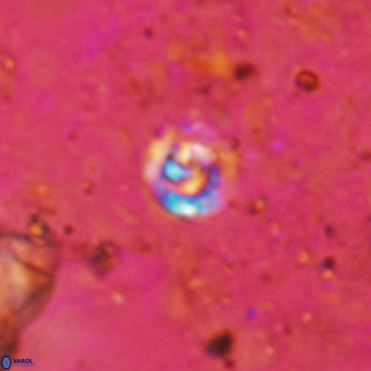 Prediscosphaera catinus VR 15764