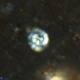Prediscosphaera catinus VR 15766
