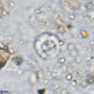 Prediscosphaera catinus VR 15771