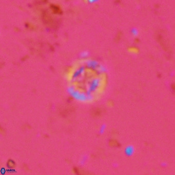 Prediscosphaera catinatus VR 13935