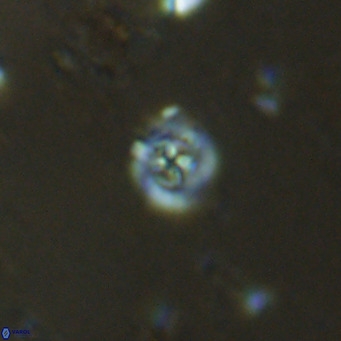 Prediscosphaera catinatus VR 13936