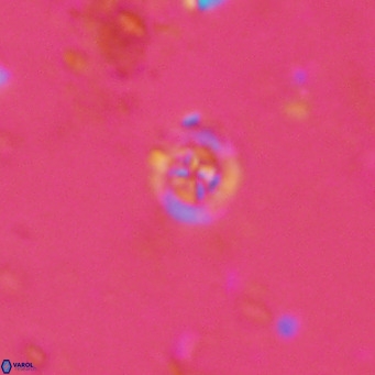 Prediscosphaera catinatus VR 13937