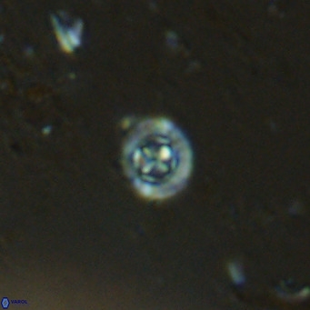 Prediscosphaera catinatus VR 13938