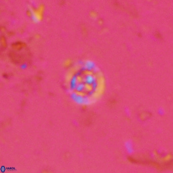 Prediscosphaera catinatus VR 13939