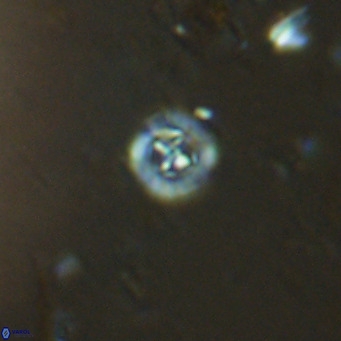 Prediscosphaera catinatus VR 13944