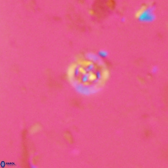 Prediscosphaera catinatus VR 13945