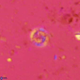 Prediscosphaera catinatus VR 13947