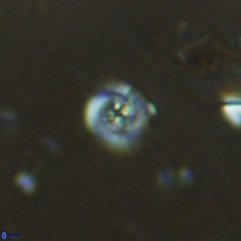 Prediscosphaera catinatus VR 13948