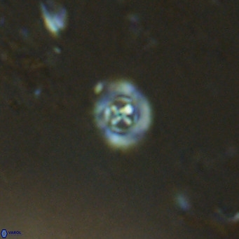 Prediscosphaera catinatus VR 13940