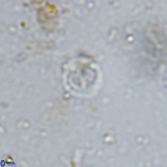 Prediscosphaera catinatus VR 13955