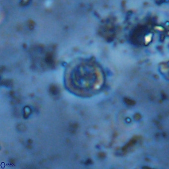 Prediscosphaera catinatus VR 13961