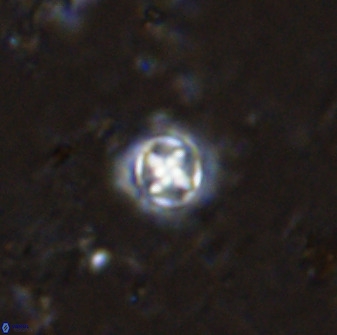 Prediscosphaera cantabrigensis 35895