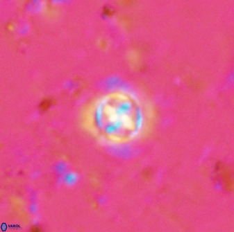 Prediscosphaera cantabrigensis 35896