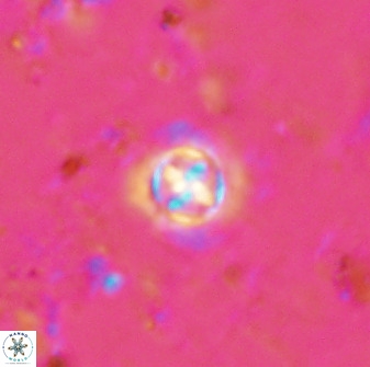 Prediscosphaera cantabrigensis 35896
