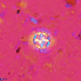 Prediscosphaera cantabrigensis 35897