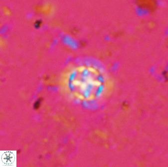 Prediscosphaera cantabrigensis 35897