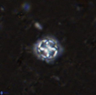 Prediscosphaera cantabrigensis 35898
